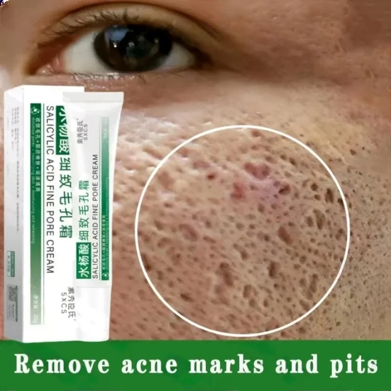 Crema per la pulizia dei pori  - Korean Lifestyle Products recensione e prezzo